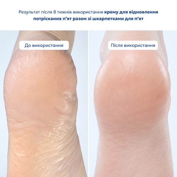 Гелеві шкарпетки для інтенсивного відновлення п&rsquo;ят HeelFix INTENSE REPAIR, 1 пара HF-01-153 фото